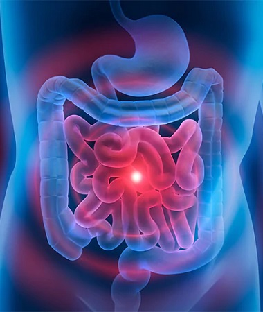 Gastrointestinal Diseases